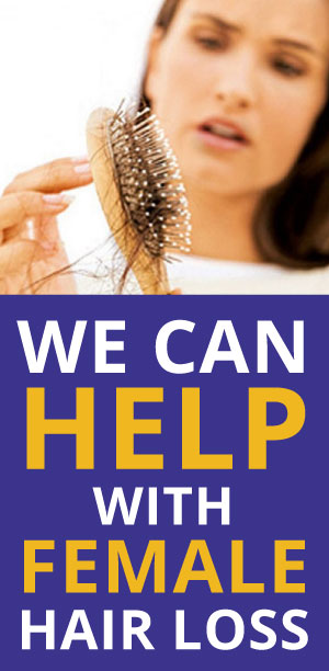 More About Female Hair Loss