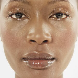 Micro-needling for all ethnicities