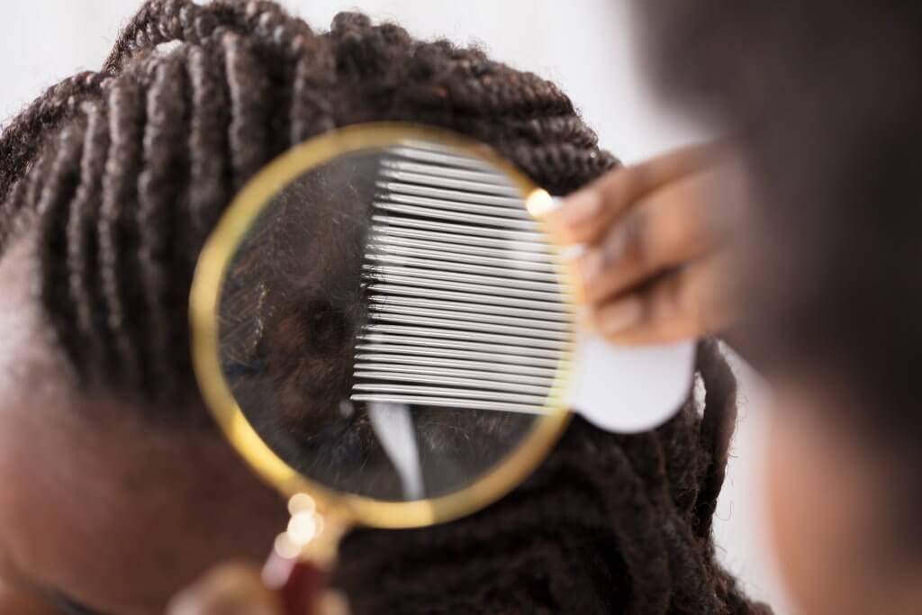 Causes of Traction Alopecia are tight hairstyles, weave, braids, and ponytails. Find out more by clicking on the image. 