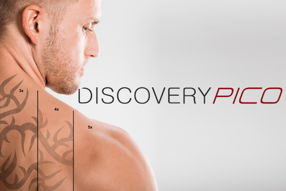Discovery Pico for tattoo Removal at Slater Aesthetic