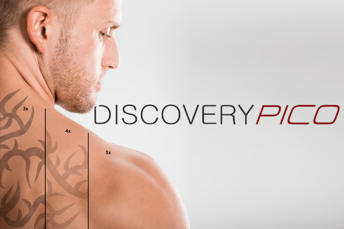 Discovery Pico Laser Tattoo Removal  Dr Monte Slater